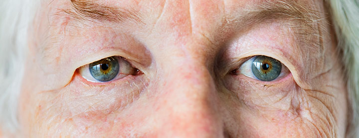 Degeneración macular