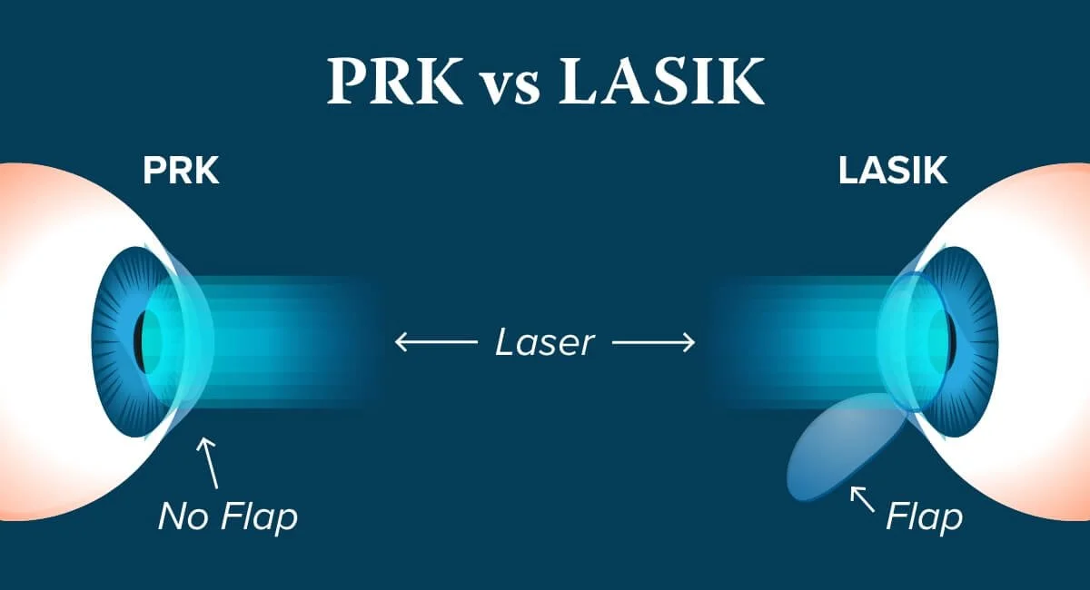 Cirugía Láser LASIK y PRK